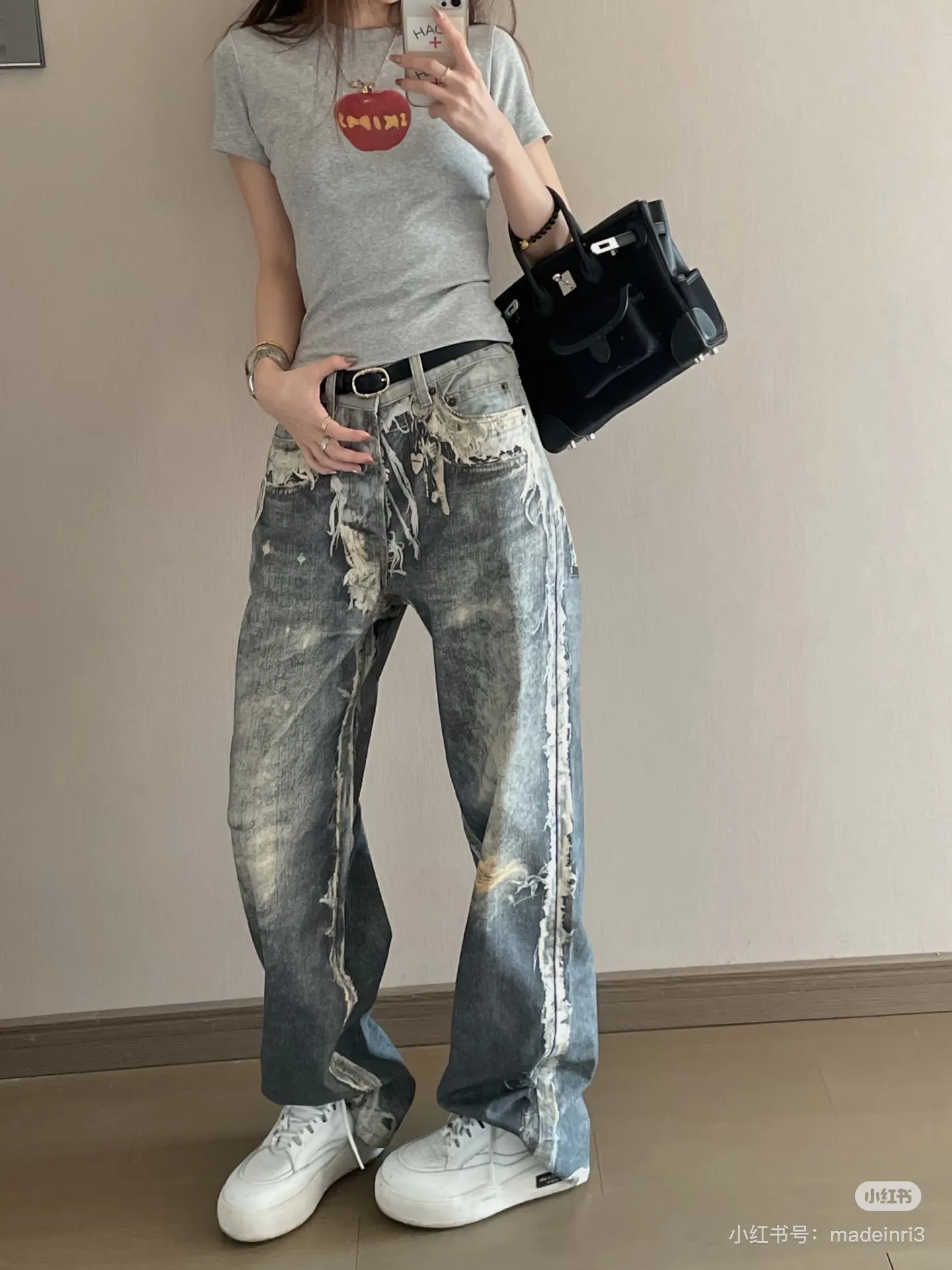 Acne 3D